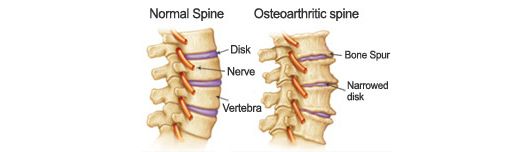 spine